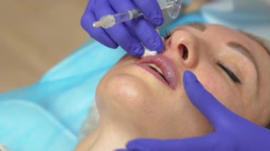 Estetik ameliyat. Sakatlanmış dudaklı kadın hiyalüronik dolgu maddesiyle tanışınca ses ve güzellik katıyor. Güzellik uzmanı hyaluronik asit enjekte edildikten sonra kan dudaklarını pamukla siliyor.