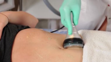 Ultrason boşluğunun vücut hatlarını düzenleme tedavisini kapat. Selülit önleyici kozmetoloji. Kavitasyon tedavisinin kapatılması, kadın hasta abdominal bölgesindeki yağ azaltımını artırır.