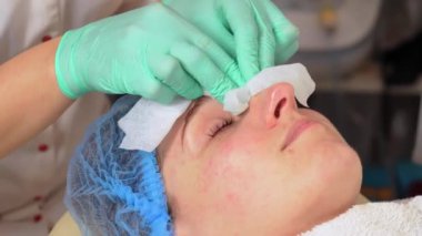 Kozmetikçi kadın yüzünü antibakteriyel peçetelerle siliyor. Doktor kozmetoloji kliniğinde güzellik prosedürü uyguluyor. Güzellik uzmanlarının elleri kozmetoloji işleminden sonra kadının yüzünü peçetelerle siliyor.