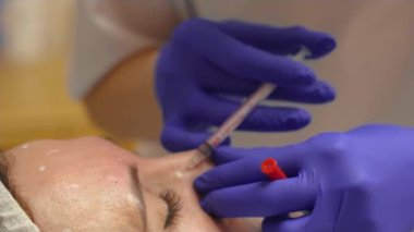 Modern kozmetik kliniğinde botulinyum terapisi yapan bir kadın. Doktor iğneyi ve şırıngayı ilaç iğnesi yapmak için kullanıyor. Kozmetik enjeksiyonlar, gençleştirme yüzü