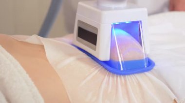 Modern teknoloji kullanarak yağ hücrelerinin çıkarılmasını kapatın. Kriyolipolisis vücut şekillendirme prosedürü. Sağlık ve zayıflama programı. Güzellik kliniği yağ tedavisi