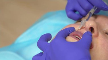 Yaklaş, kadın dudaklı. Kozmetik uzmanı şırınga kullanarak hiyalüronik asit enjekte ediyor. Dudak büyütme prosedürü. Yüz bakımı, gençlik ve güzellik için reklam kavramı