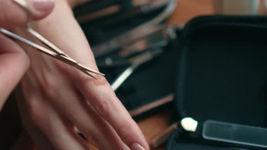 Kişisel tıbbi yardım. Kadın kolundaki termal yanığı kesmek için cerrahi makas kullanıyor. Yaradan temiz sıvı geliyor. Evde mikro cerrahi