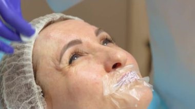 Kozmetoloji kliniği, botulinyum toksini kullandıktan sonra kasları çalıştıran genç bir kadın, cilt altında kırışıklıklara karşı ilaç dağıtıyor. Hasta dudaklarında anestezi, enjekte etmeden önce anestezi.
