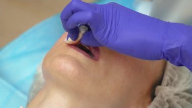 Doktor hastanın kanını durdurur. Dudaklarını büyütmek için ağız kenarındaki şırıngayı kullan. Cerrahı kapatın, tıbbi eldivenlerle, kadın dudaklarına dikkatlice ve yavaşça masaj yapın hyaluronik asit enjekte ettikten sonra.