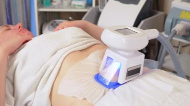 Güzellik salonunda müşterinin vakum temizleme yağının kriyolipoliz tedavi prosedürünü kapat. Modern kozmetoloji kliniğinde kriyolipoliz yağ tedavisi prosedürü