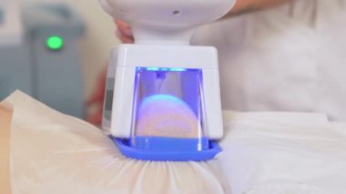 Modern teknoloji kullanarak yağ hücrelerinin çıkarılmasını kapatın. Makine kozmetolojisi. Modern kozmetoloji kliniğinde kriyolipoliz yağ tedavisi prosedürü