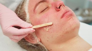 Yüz losyonu cilt bakımı sırasında kadınlarda titizlikle uygulanır. Dişi, hatta dağıtım için spatulayla nazik bir uygulama alıyor. Profesyonel olarak hidrasyon ve yatıştırıcı etkilere odaklanıyoruz.