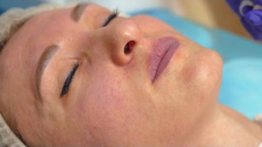 Güzellik uzmanı, hyaluronik asit zerk edildikten sonra parmak masajı yaparak kan dudaklarını pamukla siliyor. Dudak büyütme. Hyaluronik asit. Enjeksiyon işlemi