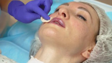 Kozmetik uzmanı kuaförde dudak büyütme prosedürü uyguluyor. Güzellik uzmanı hyaluronik dolgu malzemesi enjekte edildikten sonra kadın dudaklarını pamukla siler. Dudak büyütme. Hyaluronik asit. Enjeksiyon işlemi