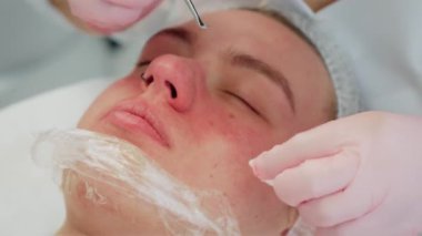 Güzellik uzmanları derin temizlik seanslarında özel aletler kullanarak cilt bakımı yapıyorlar. Müşteri, profesyonel yüz bakımı alırken rahat bir şekilde yatıyor. Rahat ve gelişmiş bakım gerçekleşiyor.