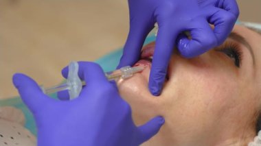 Dudak büyütme prosedürü. Profesyonel kozmetik uzmanı iğnelerden çıkan kan ve şırınga ile hiyalüronik asit enjekte ediyor. Kozmetik uzmanı güzel bir kadının dudaklarını büyütmek için iğneler yapıyor.