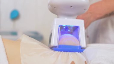 Şeklin donanım düzeltmesi. Karındaki ve belindeki yağları almak için kriyolipolisis ameliyatı olan kadına yakın durun. Donanım kozmetolojisi. Kriyolipolisis yağ tedavisi prosedürü