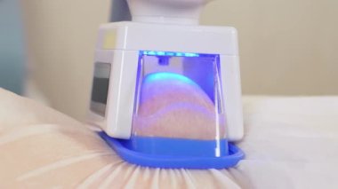 Estetik kozmetik kliniğinde kadın abdominal derisinde kriyolipolisis donanım prosedürünün yakından çekimi. Kilo fazlalığı tedavisi. Donanım kozmetolojisi ile modern sağlık kliniği