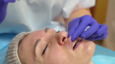 Doktor kozmetolog, dudak büyütme ve plastik işlemine hyaluronik asitle hazırlanıyor. Kozmetik uzmanı, doldurucu ve hyaluronik asit enjekte etmeden önce ince dudakları muayene eder.