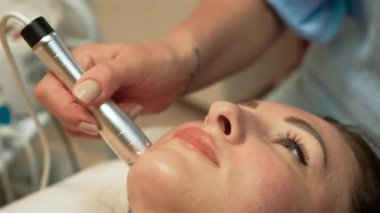 Deriyi sıkılaştırmak için çeneye radyo frekansı kırışıklık azaltma tedavisi uygulanıyor. Cilt pürüzsüzlüğünü geliştirmek için Termal RF Cilt Yenilemesi Çalıştırılıyor