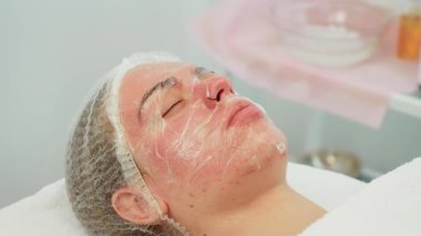 Kadın tedavi masasında yatıyor, yüzü şeffaf maskeyle kaplı, deri kızarıklığı var, rahatlamış görünüyor. Cilt bakımı sırasında dinlenen kadın, koruyucu film yüze uygulanır, sakin görünür.