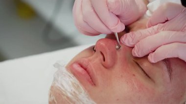 Güzellik uzmanı kozmetik uzmanı siyah başlık temizleme aleti kullanarak müşteriyi derin gözenek temizliği yapıyor. İleri seviye yüz bakımı sırasında profesyonel cilt bakımı prosedürü uygulanır. Rahatça uzanan kadın eğleniyor