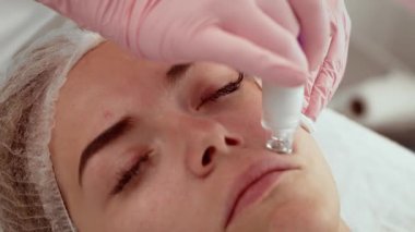 Deri atölyesinde sıvı dezenfekte cihazı tedavisi gören hasta kadın. Güzellik uzmanı, daha pürüzsüz bir cilt yüzeyi için gelişmiş teknolojiyi dikkatlice uyguluyor. Yenilenme amaçlı invazif olmayan prosedür