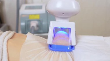 Modern kozmetoloji kliniğinde kriyolipolisis yağ tedavisi prosedürü. Modern teknoloji kullanarak yağ hücrelerinin çıkarılmasını kapatın. Makine kozmetolojisi