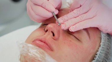 Profesyonel kozmetoloji prosedürü, siyah başlık temizleme aracını kullanarak müşterinin rahat bir ifadeyle yatmasını sağlıyor. Gelişmiş cilt bakımı sırasında derin gözenek temizleme işlemi yapıldı. Temiz klinikte yüksek kaliteli yüz bakımı gören bir kadın.