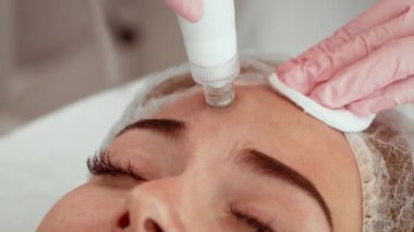 Deri bakım kliniğinde derin gözenek temizliği için su kabuğu soyma tedavisi gören hasta kadın. Güzellik uzmanları alnın üzerinde gelişmiş bir cihaz taşıyarak deriyi soyuyor ve sulandırıyor. Profesyonel estetik prosedür cilt dokusunu ve ışıltısını geliştirir.