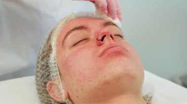 Kozmetoloji terapisi sırasında uygulanan enzim maskesi soyma işlemi. Eldivenli eller daha yumuşak bir cilt için nazikçe temizlik ve deri yüzme yapıyor. Gençleştirme ve cilt dokusunun iyileştirilmesine odaklanan profesyonel tedavi