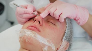 Güzellik uzmanları tarafından kozmetoloji müşterilerinde kullanılan siyah başlık temizleme aleti. Profesyonel cilt bakımı sırasında derin gözenek temizleme prosedürü. Kadın, temiz ve rahat klinik ortamında yüz tedavisinden zevk alıyor