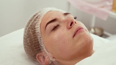 Yüzünde lokal anestezi olan hasta sakince estetik ameliyata hazırlanıyor. Uyuşma faktörü ameliyattan önce etkisini gösterirken klinik ortamda bireysel dinlenme. Kadın rahat ve estetik ameliyat için tıbbi hazırlık altında bekliyor.