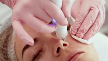 Hasta kadın yüz gençleştirme kliniğinde vakumlu yüz temizleyicisiyle tedavi görüyor. Güzellik uzmanı gelişmiş deri dokusu için kusursuz temizlik prosedürü uyguluyor. Derin gözenek arındırma için tasarlanmış nazik ve etkili bir teknoloji.