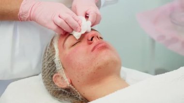 Kadın müşteriyi hassas ve nazik bir şekilde tedavi eden sertifikalı estetik uzmanı. Eldivenli eller yumuşak pamuk pedleri sürerek hassas cildi rahatlatıyor. Yüzün yenilenmesi sırasında cilt durumunu iyileştirmeye odaklanma