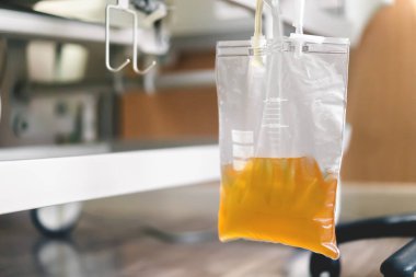 İdrar torbası, idrar torbası hastanede hasta yatağının altında asılı. Sağlık ve tıbbi konsept..