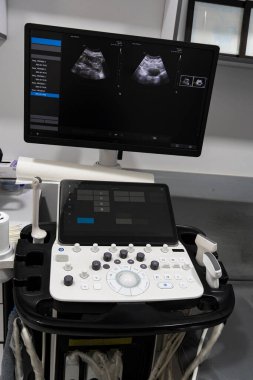 İki sonda, dokunmatik ekran arayüzü ve tıbbi teşhis ve hasta bakımı için kontrol paneli olan gelişmiş ultrason sistemi.