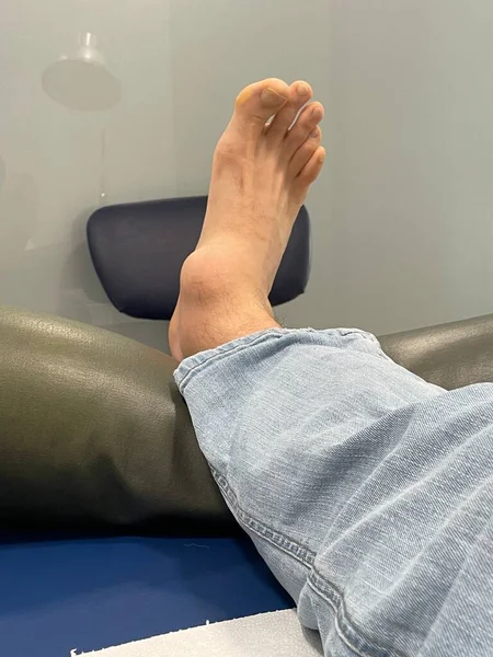 Ayak bileği şişmiş bir erkek ayağı, bir kaza geçirdikten sonra klinik sedyesinde yatıyor. Yüksek kalite fotoğraf