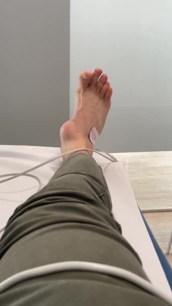 Ноги Человека Правая Нога Опухшей Лодыжкой Воспаления Лежащая Носилках Медицинской — стоковое видео