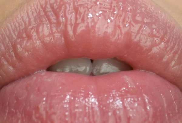 Injeções Enchimento Lábios Macios Sensual Boca Feminina — Fotografia de Stock