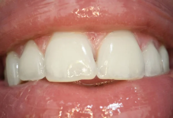 口の中で赤い唇で笑う 極端な口を閉じて マクロセクシー唇 歯のケア 健康的な歯と笑顔 口の中で白い歯 口を開けて — ストック写真