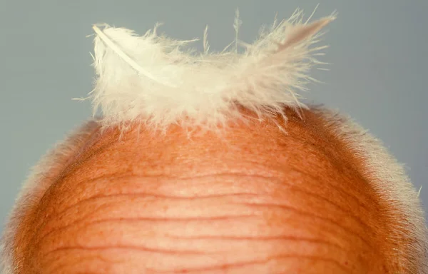 男性のヘアケア 老けていく 大胆な男の頭 年配の男性 脱毛と健康問題の概念 — ストック写真