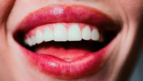 笑着的女人嘴与伟大的牙齿关闭 健康的白牙牙齿洁白健康的笑容 — 图库照片