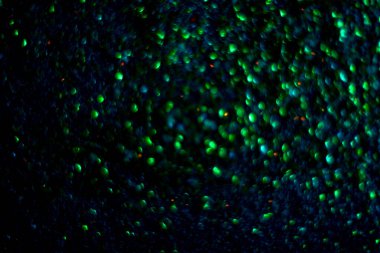 soyut ışıltı arka planı aydınlatır. Sanat ışıkları. Dekorasyon bokeh ışıldıyor, arkaplan bokeh ile soyut parlıyor. Sanat tasarımı arka planda bulanık efektli parıldayan kıvılcımlar oluşturur