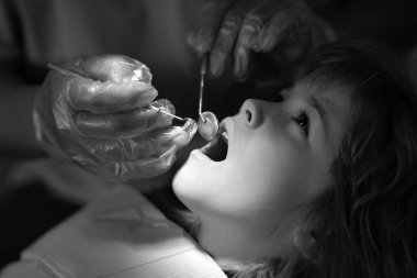 Doktora sözlü muayene sırasında ağzı açık bir şekilde dişçi koltuğunda oturan tatlı çocuk. Dişçi muayenehanesi. Çocukların stomatolojisi. Ağız boşluğu