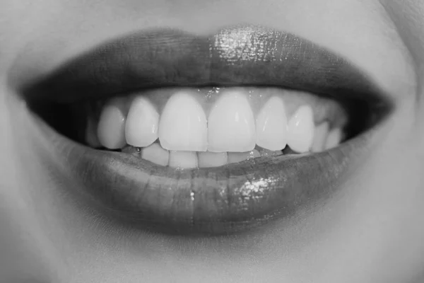 Latter Kvinde Mund Med Store Tænder Perfekt Smil Efter Blegning - Stock-foto