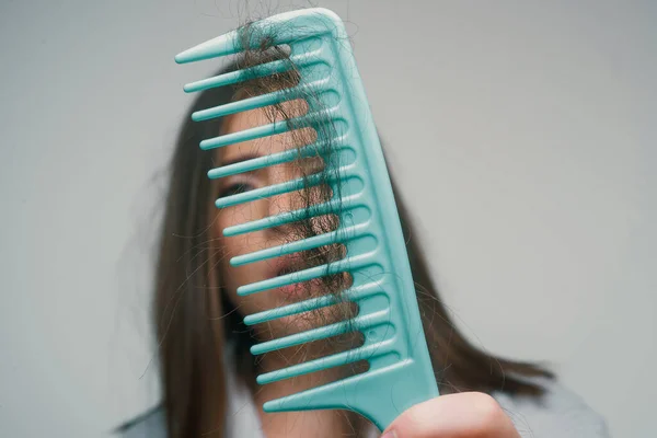 Gros Plan Cheveux Problématiques Macro Soins Capillaires Concept Perte Cheveux — Photo