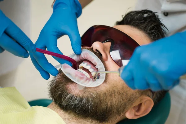 Usuwanie Próchnicy Zębów Uzupełniania Ubytków Naprawić Pęknięcia Lub Złamania Zębów — Zdjęcie stockowe