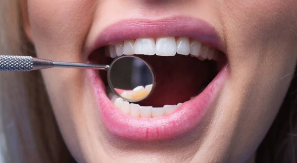 Clínica Dental Dientes Examinados Dentistas Dientes Mujer Sanos Espejo Bucal —  Fotos de Stock