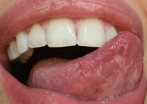 Dental care, healthy teeth and smile, white teeth in mouth. Closeup of smile with white healthy teeth. Open mouth, tongue touches the teeth