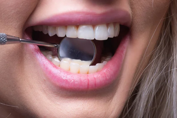 Los Dientes Del Dentista Miran Cerca Examen Dientes Con Espejo —  Fotos de Stock