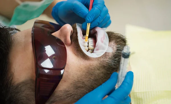 在现代牙科诊所用镜子检查病人牙齿的女牙医 患者在牙科诊所用紫外线进行牙科检查 年轻人在牙医那里选择牙齿的颜色 — 图库照片