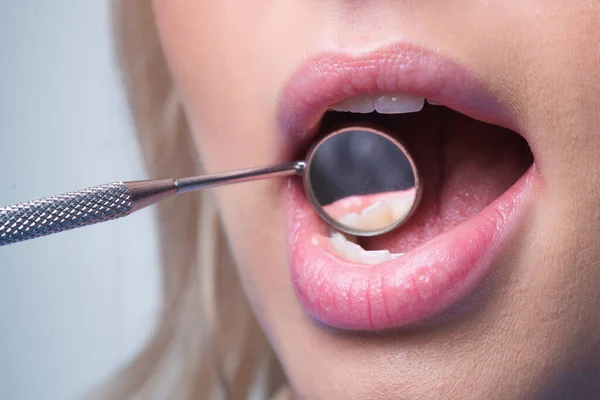 Mulut Dokter Gigi Cermin Close Pemeriksaan Gigi Dengan Cermin Gigi — Stok Foto