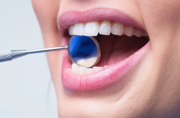 Les Dents Reflètent Gros Plan Examen Des Dents Avec Miroir — Photo